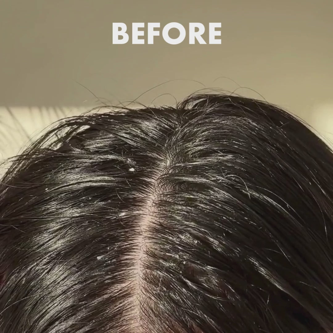 umberto-giannini_video_Rosemary-Hair-and-Scalp-Oil-50ml